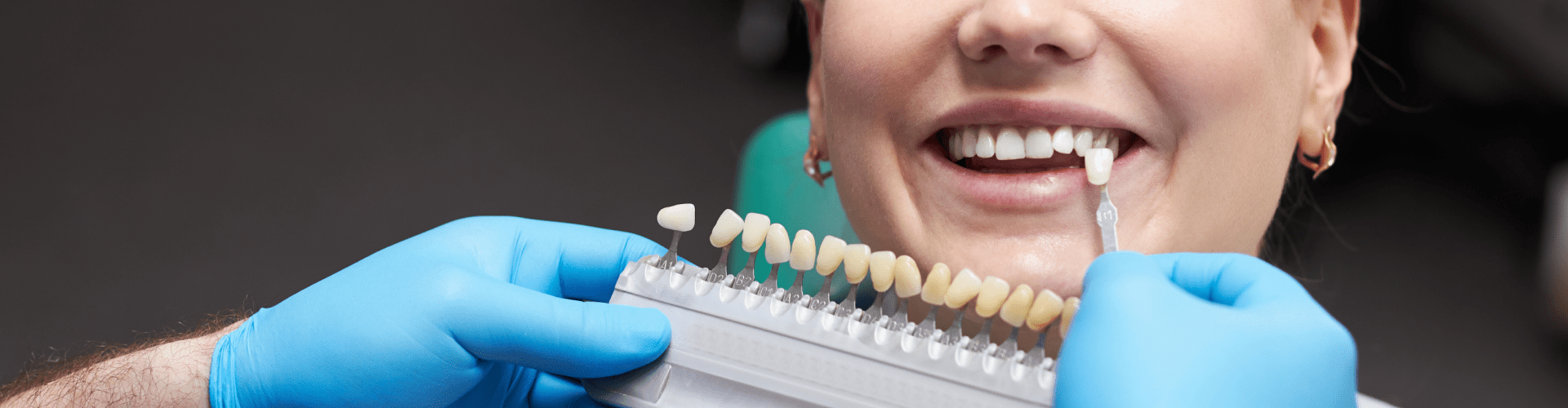 Gloved hands holding tooth shade-matching tool in front of smiling woman.